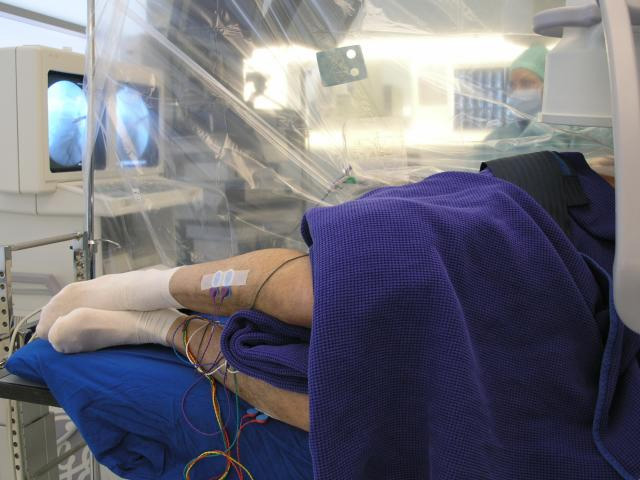 Elektroder til nervekontrol ved en endoskopisk operation i ænderyggen